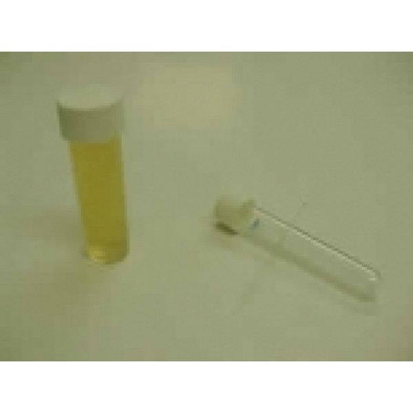 Anaerobic Culture Tubes SRB (Box 10) 